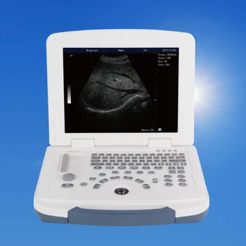 Terhességi Vizsgálat, Orvosi Fekete-Fehér Mini Ultrahangos Szkenner Emberi